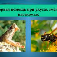 Действия при укусах насекомых, змей